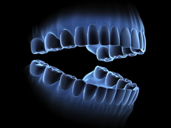 Рентгеновские снимки зубов