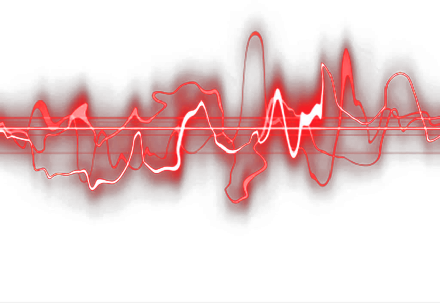 Эффект сердцебиения. Линия пульса на прозрачном фоне. Звуковая волна. Импульс на белом фоне. Пульс без фона.