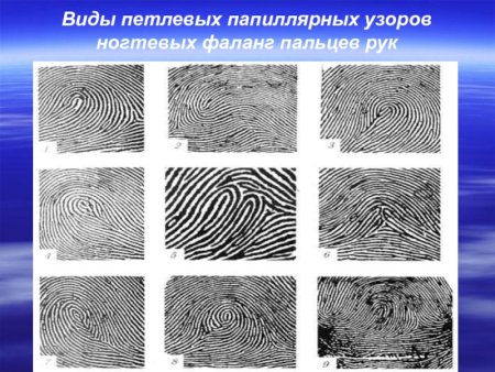 Дуговой узор папиллярных линий Дельта
