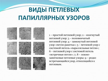 Определите Тип и вид папиллярного узора