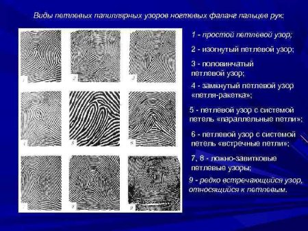 Типы папиллярных узоров Дельта