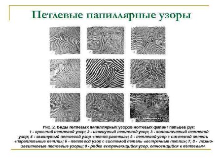 Виды петлевых папиллярных узоров