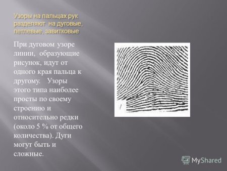 Замкнутый (петля-ракетка) папиллярных узор