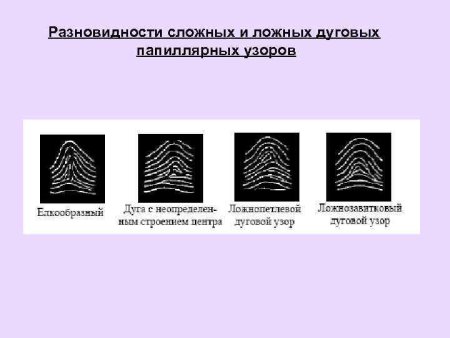 Петлевой папилярныузоры