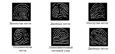 Петлевой Тип папиллярных узоров