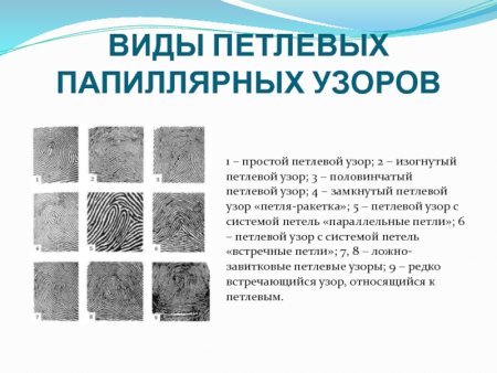 Виды петлевых папиллярных узоров