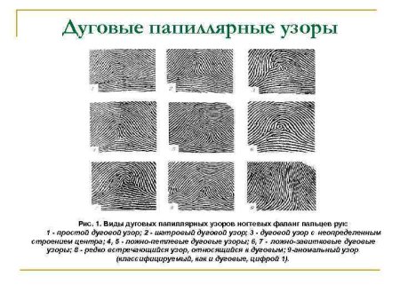 Виды петлевых папиллярных узоров