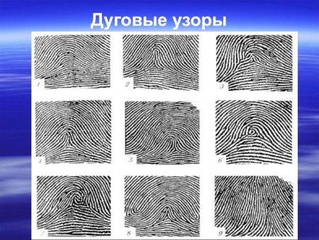 Дерматоглифика типы узоров