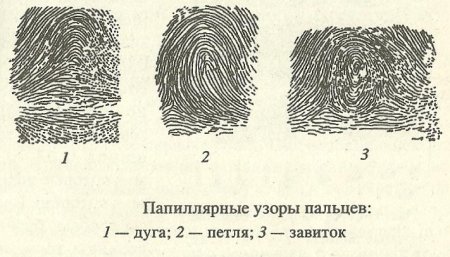Зарисуйте основные типы узоров папиллярных линий
