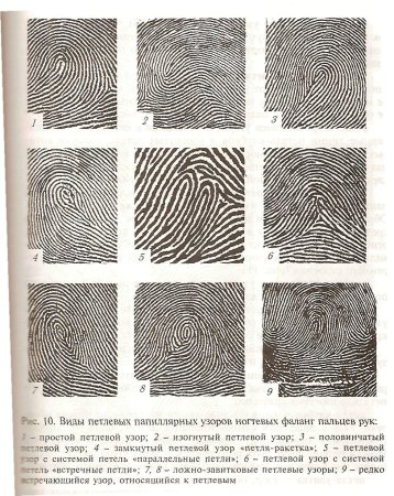 Типы папиллярных узоров пальцев