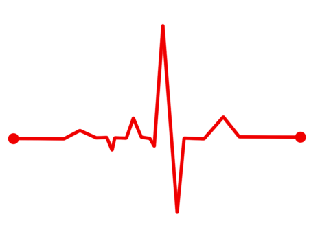 Диаграмма биения сердца