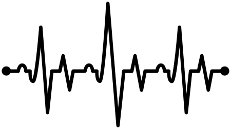 ЭКГ сердца