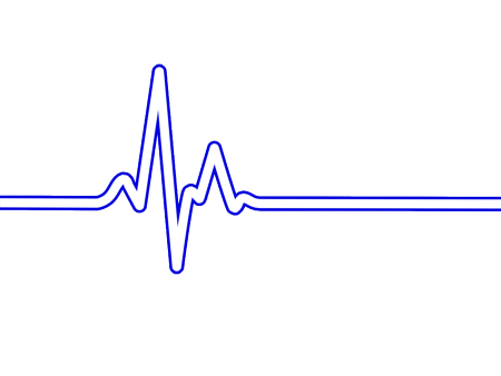 P Wave ECG