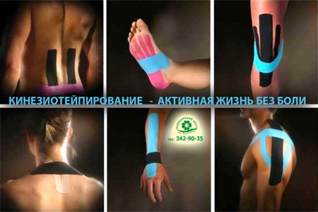 Тейпы у гимнастов