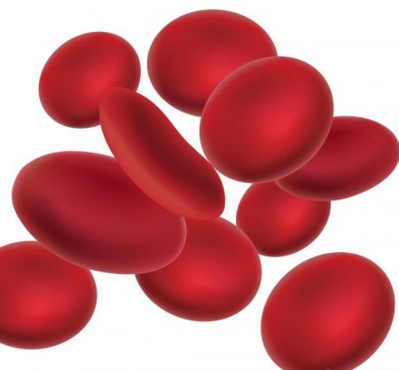 Anemia pictures
