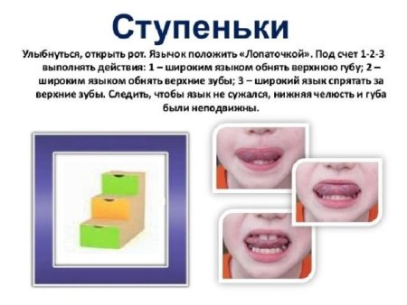 Артикуляционное упражнение ступеньки