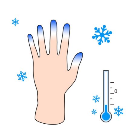Обморожение иллюстрации