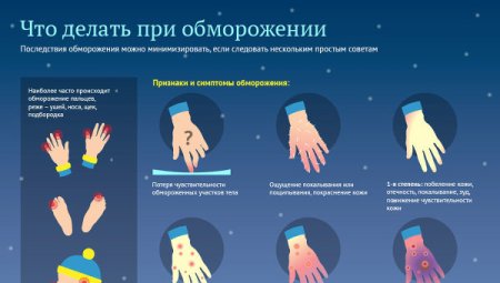 Степени обморожений в разрезе кожи