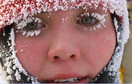 Обморожение вектор