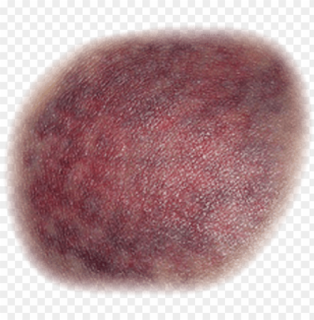 Синяки для фотошопа без фона