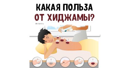 Вакуумный массаж хиджама