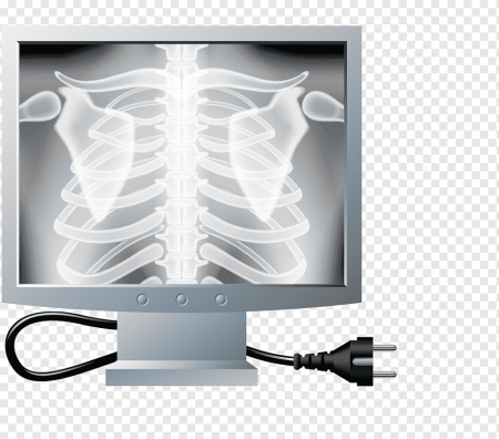 Рентген "x-ray Diagnostics Radrex (Mrad-a50s/g6)", Canon