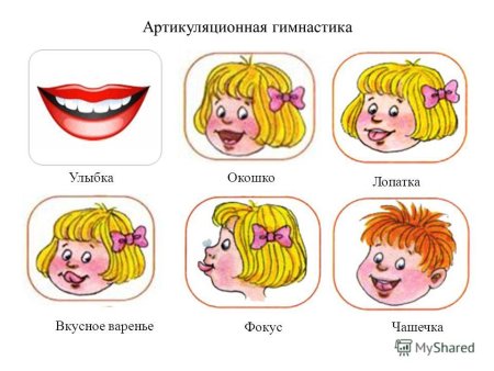 Логопедические упражнения артикуляционная гимнастика