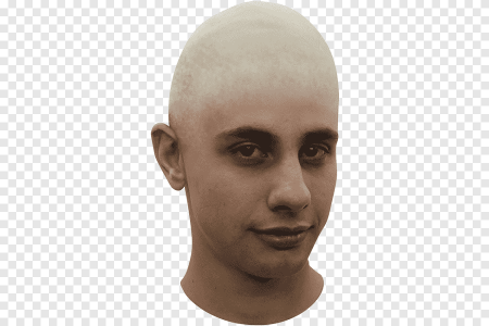 Лысая голова