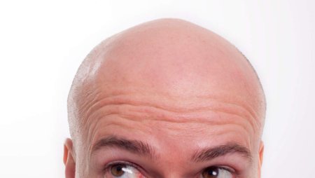 Лысая башка