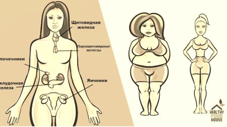 Гормональный фон и лишний вес