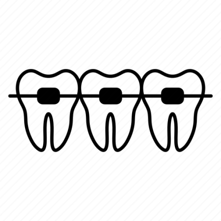 Брекеты контуры